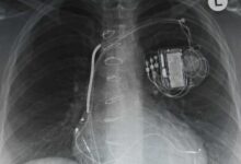 Medtronic brings e commerce to medical device industry