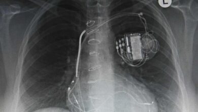 Medtronic brings e commerce to medical device industry