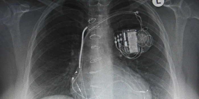 Medtronic brings e commerce to medical device industry